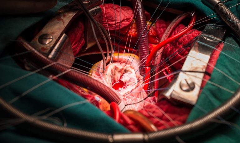 Cardiothoracic surgery in Dubai