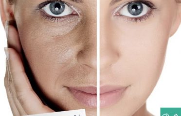 Riva Laser Medical Center