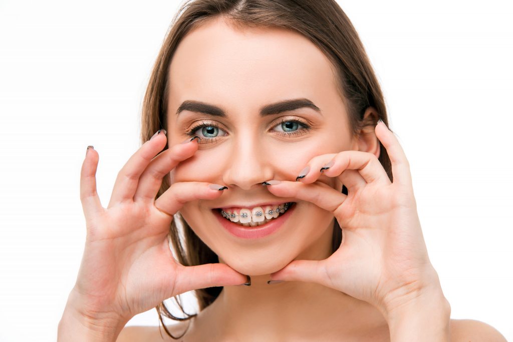 Why Do You Need Braces?